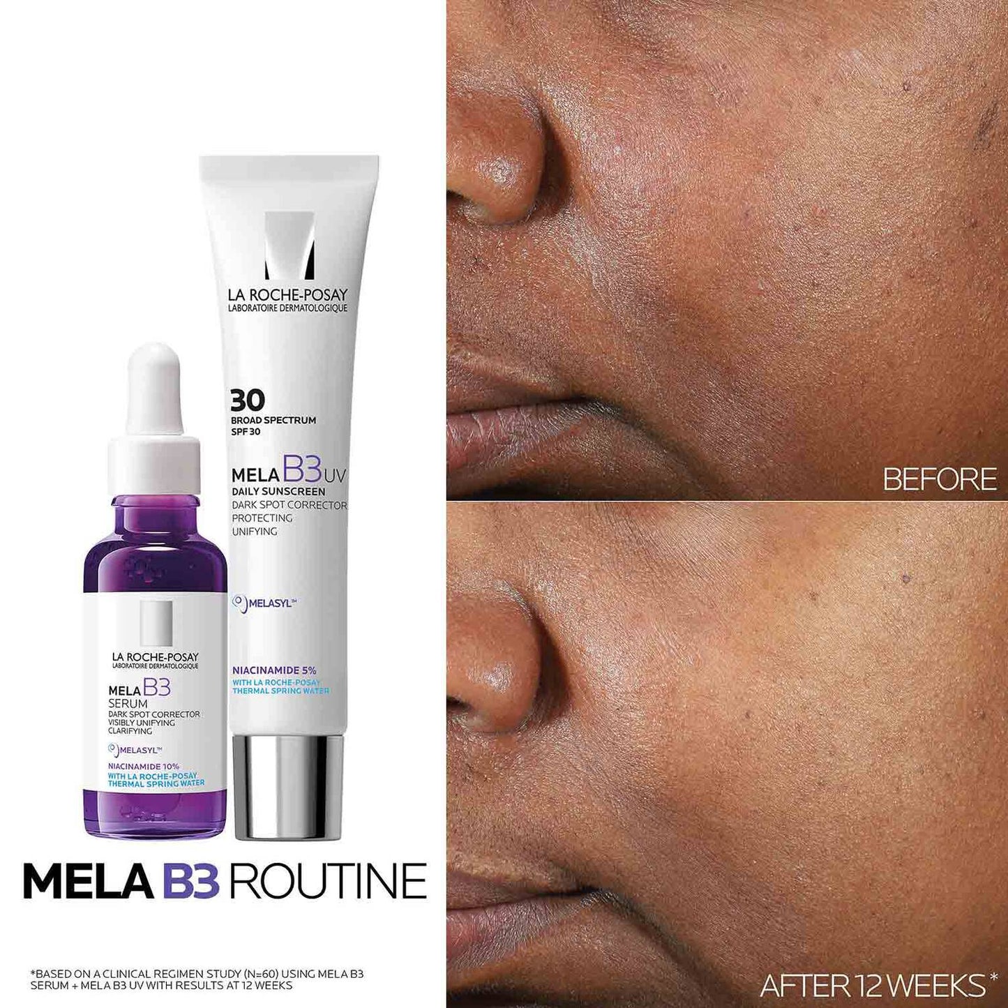 mela-b3-uv-daily-moisturizer-spf-30-with-melasyltm-niacinamide-p9 Mela-B3-routine_1500X1500.jpg